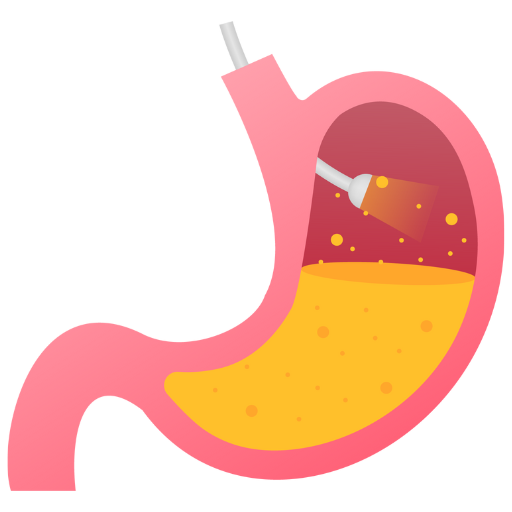 Gastroscopy nicon